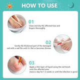 Nail Nurture Bee Venom 60 ml Pack of 2